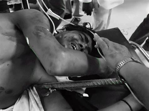 Aligarh Worker Chest Pierced by Iron Rod | Injured in Accident