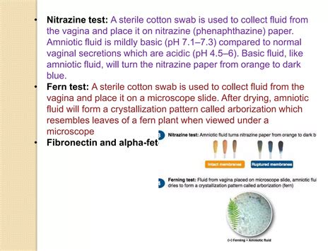 Pre-Labor Rupture of Membranes (PROM) | PPTX