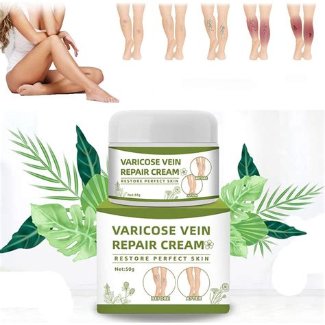 Buy BeauSkin Spider Veins Repair Cream, Veins Repair Varicose Cream ...