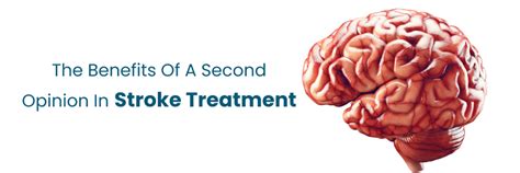 Benefits of a Second Opinion in Stroke Treatment
