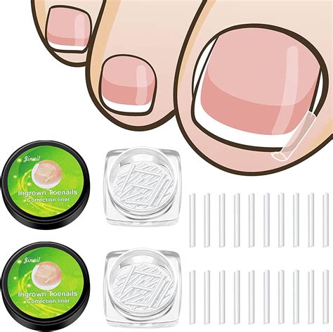 Ingrown Toenail Corrector Strips Toenail Correction Patches Curved Toenails Straightening ...
