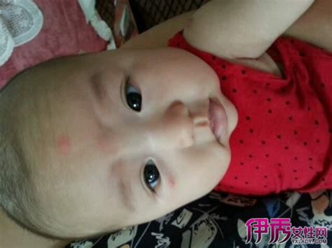 【婴儿脸上起小红疙瘩】【图】婴儿脸上起小红疙瘩怎么办 4步教你轻松应对婴儿脸上的小红疙瘩(4)_伊秀亲子|yxlady.com
