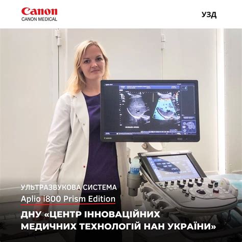 Новітня ультразвукова система Aplio i800 Prism Edition для сучасної ...