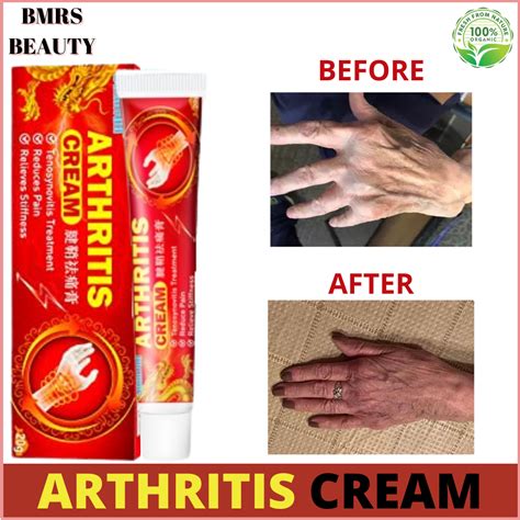 Creams For Arthritis Relief at Joel Morton blog