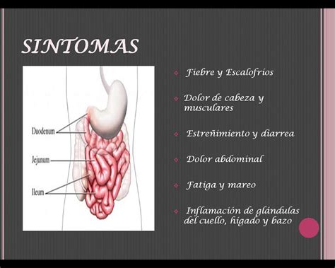 Fiebre tifoidea; Fiebre Entérica; Tifus Abdominal