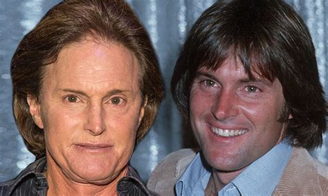 Bruce Jenner Before Face Surgery