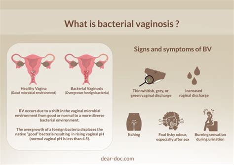 Understanding Bacterial Vaginosis - Ask The Nurse Expert