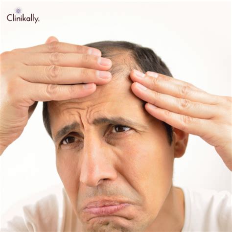 Does Pre-Workout Supplements Cause Hair Loss? | Clinikally