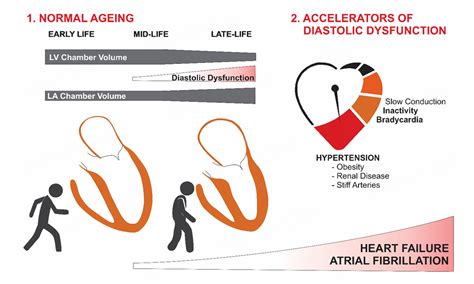 Aging diastole - root cause for atrial fibrillation and heart failure with preserved ejection ...