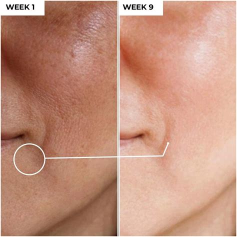 Best Skincare Products in India | Get Upto 40% OFF