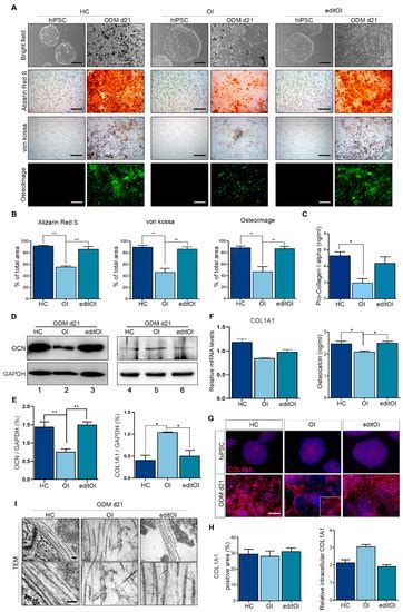 Restoration of Osteogenesis by CRISPR/Cas9 Genome Editing of the ...