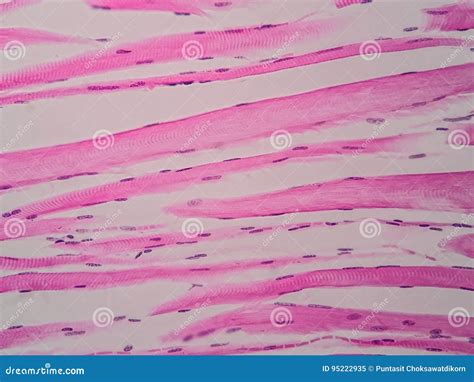 Image result for Skeletal Muscle Tissue Under Microscope