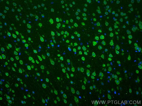 HuD-specific antibody (24992-1-AP) | Proteintech