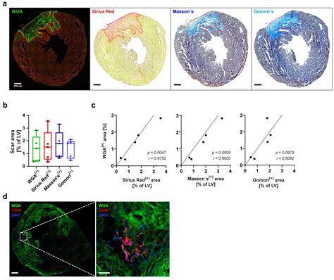 Novel Fluorescence-Based Methods to Determine Infarct and Scar Size in ...