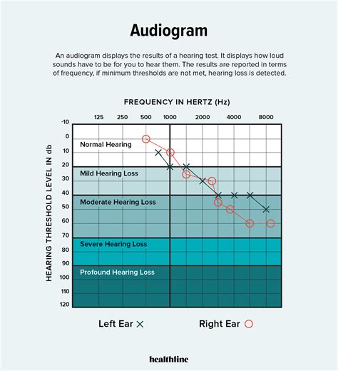 How to read your audiogram – Artofit
