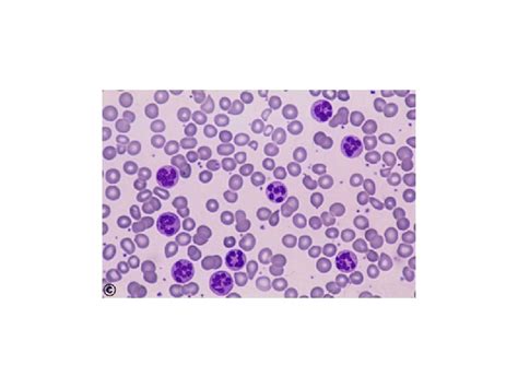 Image result for Retics Count by Flow Cytometry