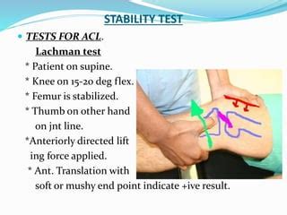 Image result for Lachman Testing