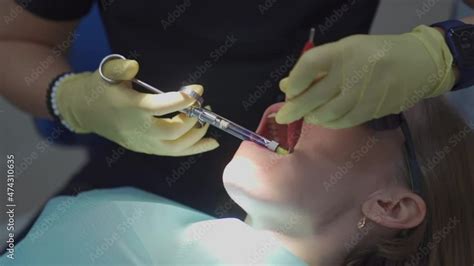 Image result for Tooth Extraction Injection