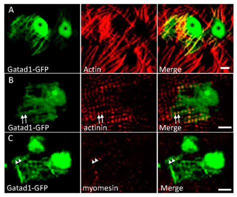 Modeling GATAD1-Associated Dilated Cardiomyopathy in Adult Zebrafish