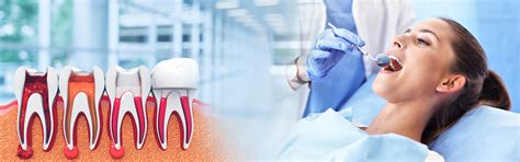 Best Root Canal Treatment in KPHB, Kukatpally, Hyderabad