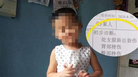 哈尔滨4岁女童疑被邻居侵犯 至今仍在ICU救治_手机新浪网