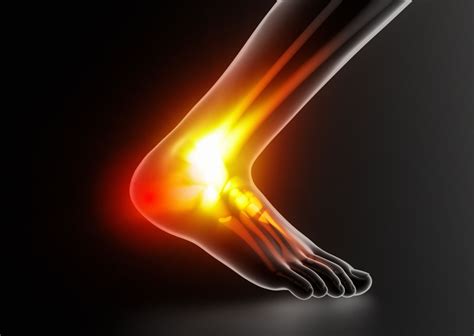 Heel Pain After Running? Try This! - Loving Life