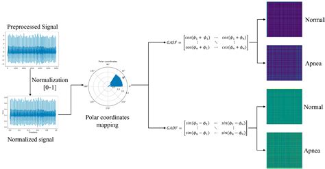 Multi-Feature Automatic Extraction for Detecting Obstructive Sleep ...