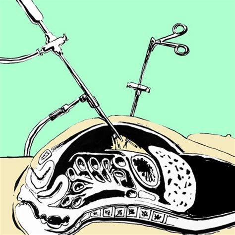 Image result for Embalm Process