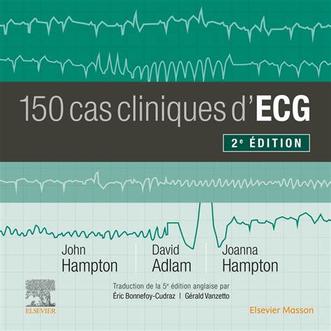 Buy 150 cas cliniques d'ECG Book Online at Low Prices in India | 150 ...