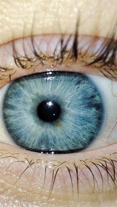 Noticed this brown splotch today and also the swirl starting from the ...