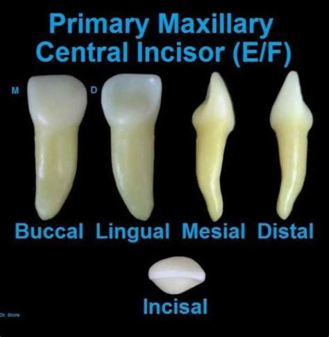 Primary Maxillary Central Incisor - MEDizzy