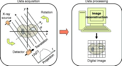 CT Image Acquisition and Reconstruction: From Physics to Pixels
