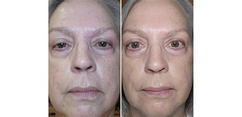 Results | Cellexia Labs