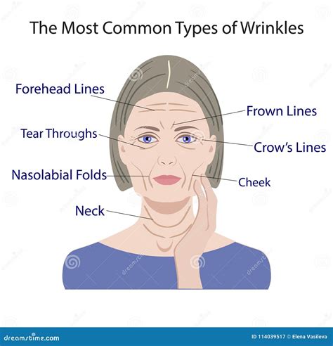 Common Types of Facial Wrinkles. Cosmetic Surgery Stock Vector - Illustration of bunny, damage ...