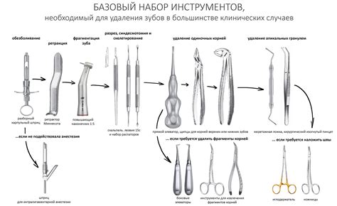 Простое удаление зуба за 10 шагов — CLINICIN.RU