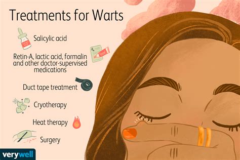 Warts: Overview and More
