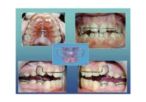 Dr. Rohan Mascarenhas