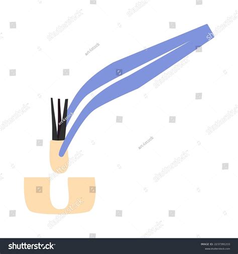 23 Manual Fue Hair Transplant Images, Stock Photos & Vectors | Shutterstock