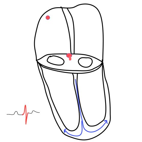 Image result for Understanding Cardiac Current