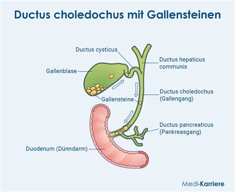 Ductus choledochus: Anatomie, Verlauf und Klinik