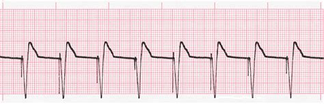 Image result for Basic EKG Training