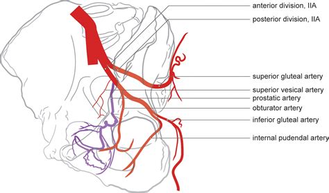 Prostatic Artery Embolization for Benign Prostatic Hyperplasia: Patient ...