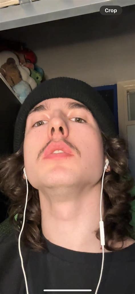 two painful “balls” under my chin, neck swells up like a toad when i ...