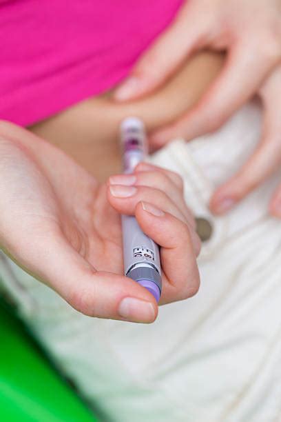 Image result for Subcutaneous Button Device