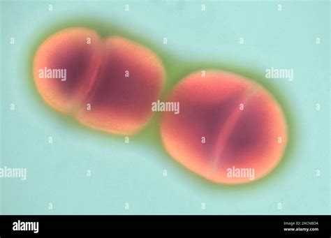 Image result for Enterococcus Faecalis Bacteria Cell Structure