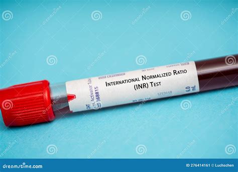 International Normalized Ratio (INR) Test Stock Image - Image of used, therapy: 276414161