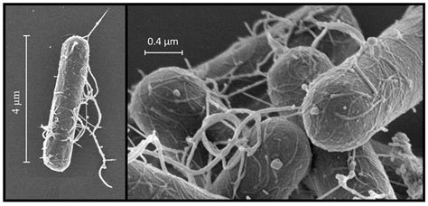 The Latent Threat in Wild Birds: Clostridium botulinum