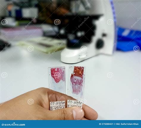 Scientist Holding Microscopic Glass Slide for the Diagnosis of Cytology Department ...