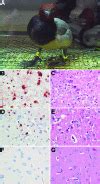 Wild Ducks as Long-Distance Vectors of Highly Pathogenic Avian ...