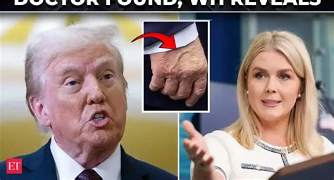 ‘Trump wanted transparency’: WH reveals shocking truth behind his ...